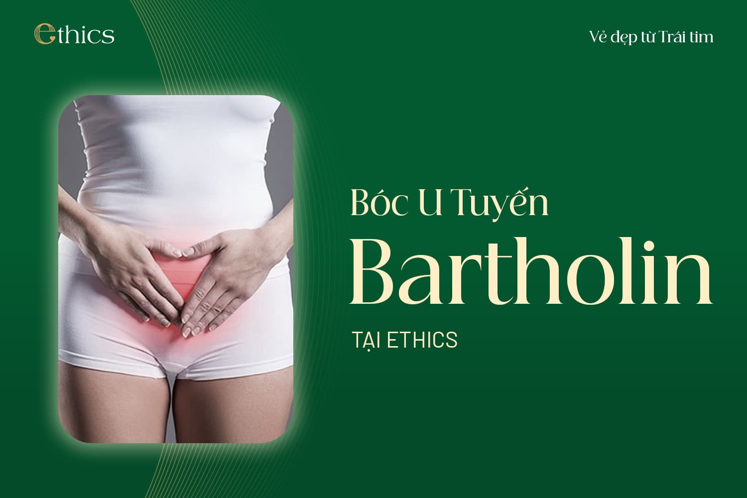 Pengangkatan kista kelenjar Bartholin