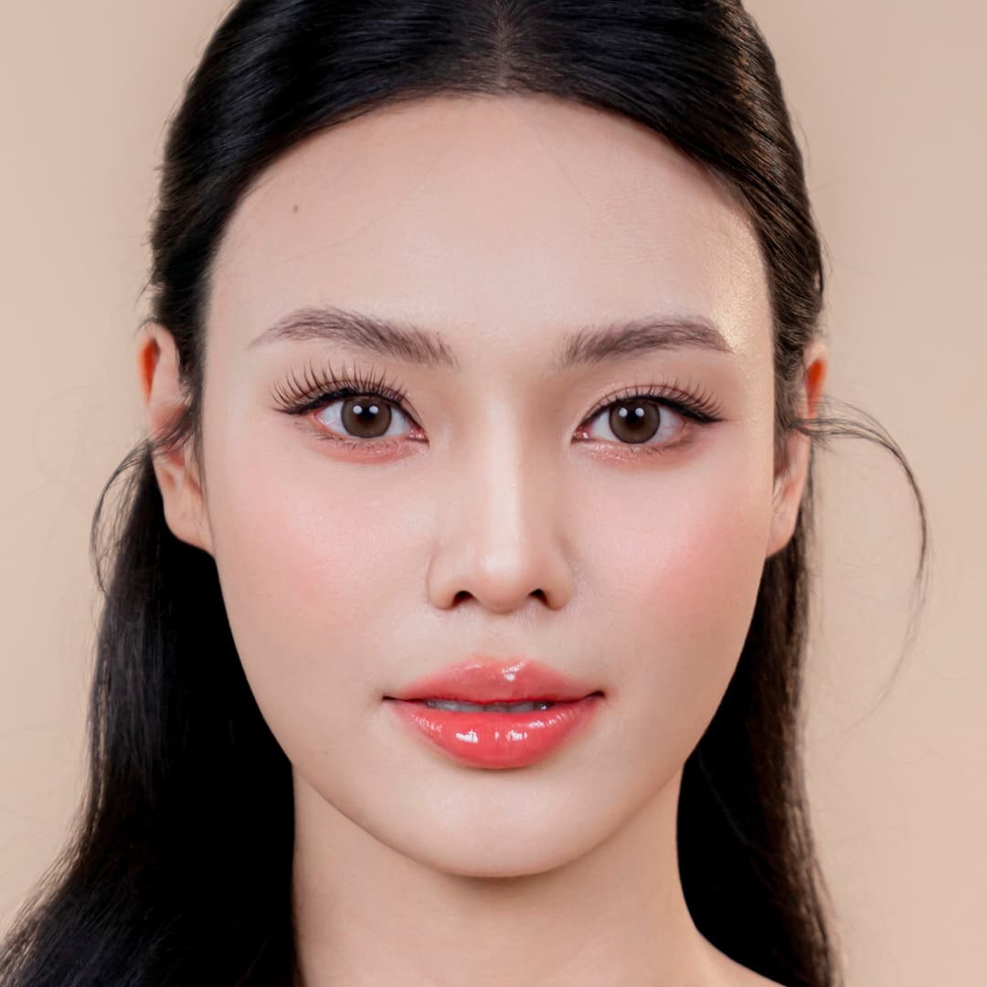 Pelanggan Lưu Phương Anh - Setelah tindakan operasi hidung One fit (Tampilan dekat)
