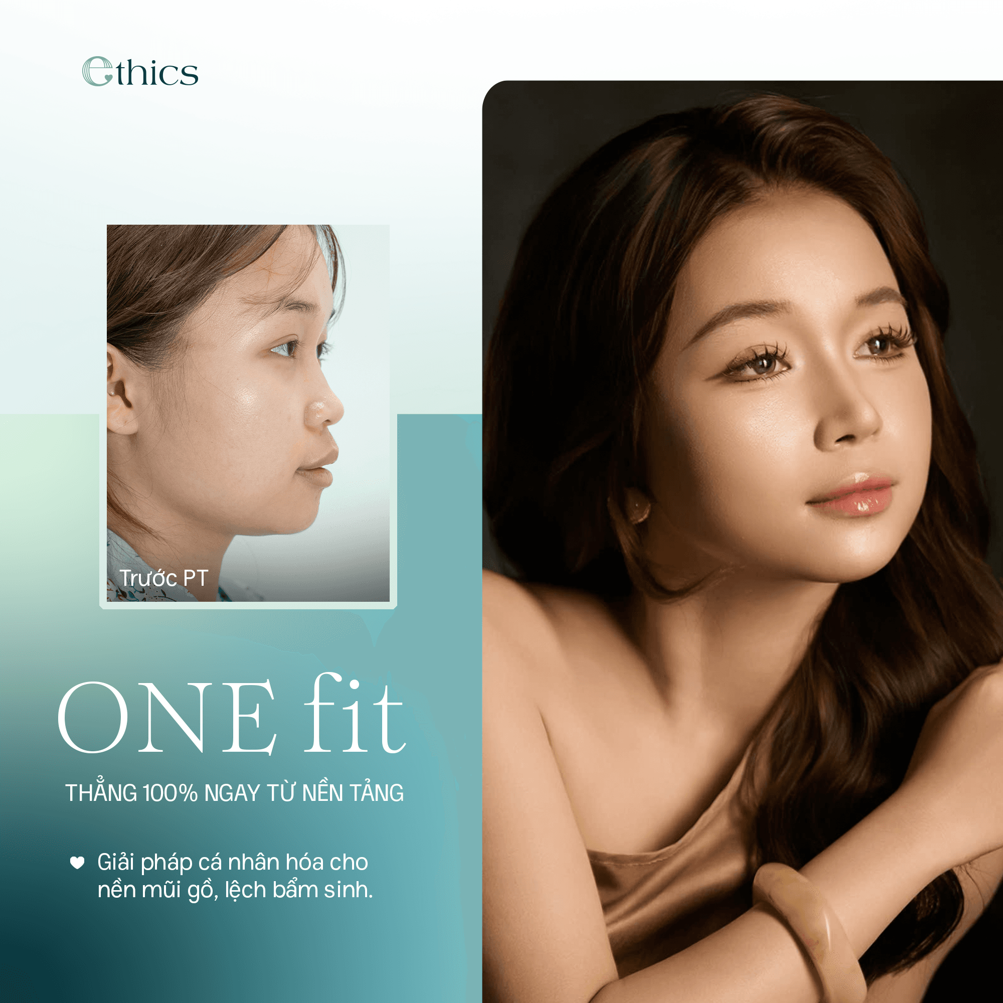 Implan dagu OneFit