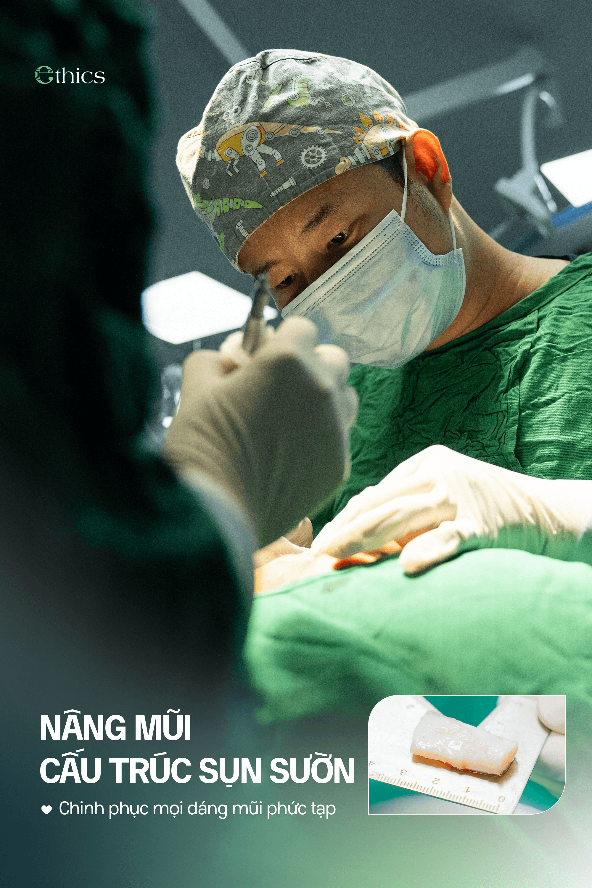 NÂNG MŨI CẤU TRÚC SỤN SƯỜN - CHINH PHỤC MỌI DÁNG MŨI PHỨC TẠP